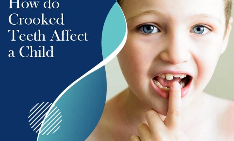 How do crooked teeth affect a child?