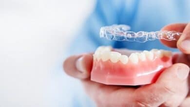 what-you-know-about-invisalign-smile-and-what-youre-not-educated-about-invisalign-smile