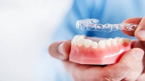 what-you-know-about-invisalign-smile-and-what-youre-not-educated-about-invisalign-smile